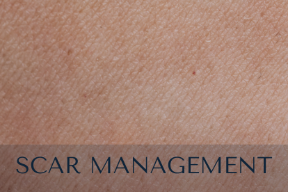 Scar Management. Close-up image of skin. Specialized products to help treat scars after surgery.